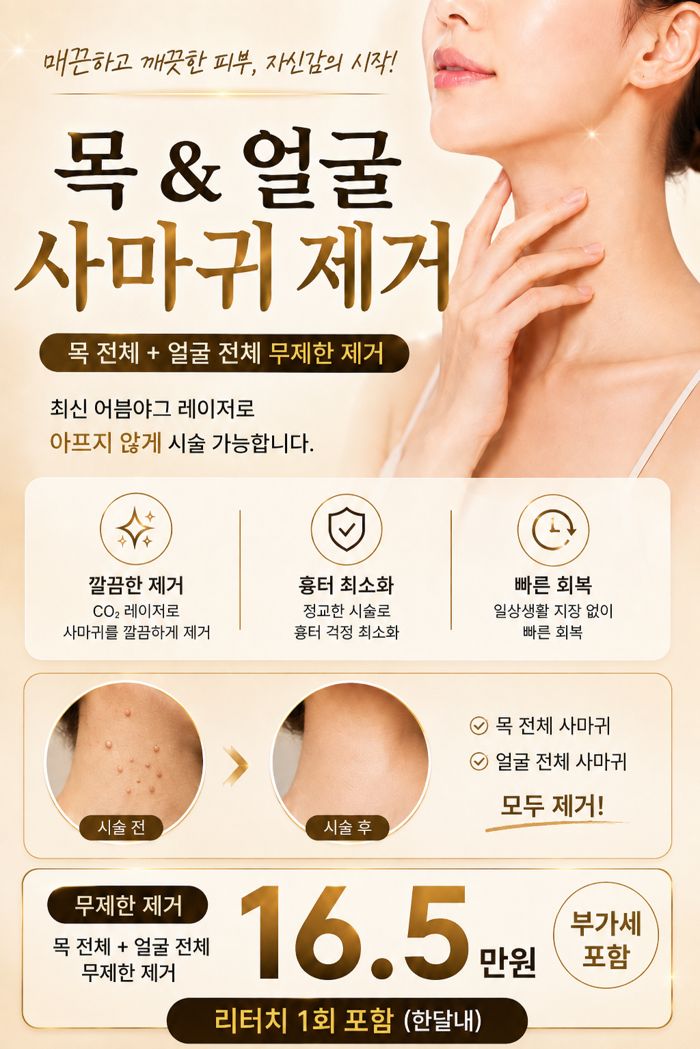 목 얼굴 사마귀 제거 이벤트